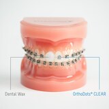 OrthoDots CLEAR, Pain and Irritation Relief from Orthodontic Appliances, 16 CT, thumbnail image 5 of 5