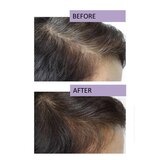 RapidHair Hair Volumizing Formula, 1.69 OZ, thumbnail image 3 of 4