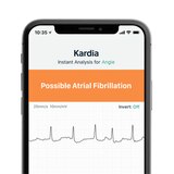 AliveCor KardiaMobile Personal EKG Monitor, thumbnail image 5 of 5